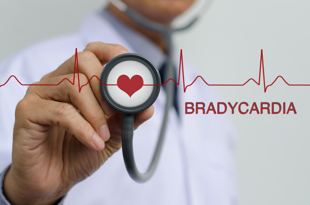 bradycardia-symptoms-causes-and-treatment