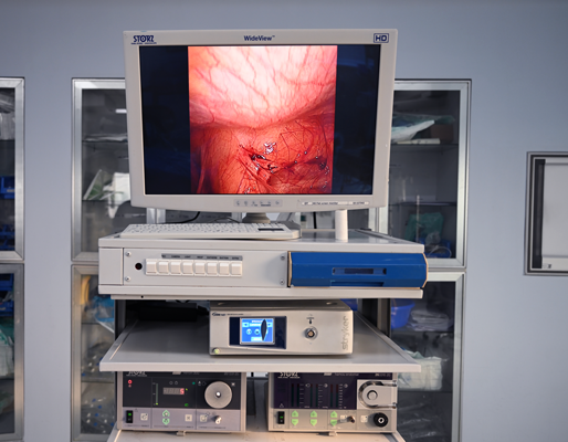 Video Assisted Thoracic Surgery (VATS)