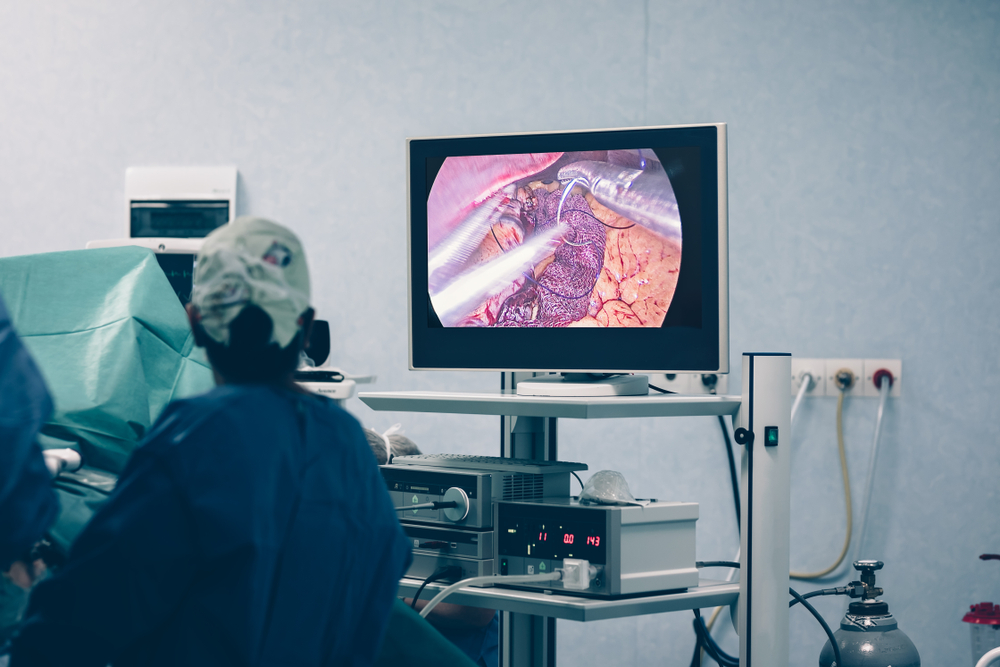 3d-advance-laparoscopic-surgery