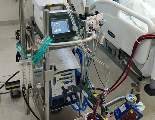 High-Frequency ventilation and ECMO